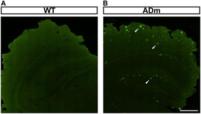 Alzheimer’s Disease Mutant Mice Exhibit Reduced Brain Tissue Stiffness Compared to Wild-type Mice in both Normoxia and following Intermittent Hypoxia Mimicking Sleep Apnea